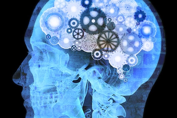 Significant changes are on the horizon for Canadian patent prosecution